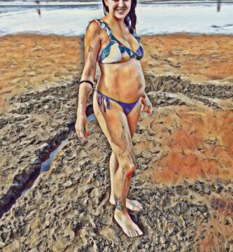 Mujer embarazada, cistocele.